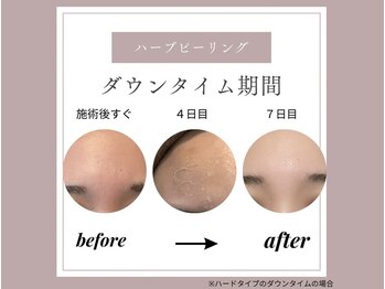 アイル 博多祇園店(iru)/