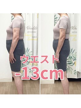 トータルボディーケアステーション 岡山院/60代　耳ツボ　お腹が大きく変化