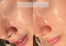 シューラディアント 金沢店(ShuRadiant)