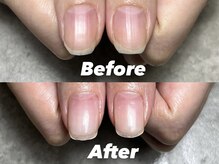 結(Yui)/自爪育成 Before→After