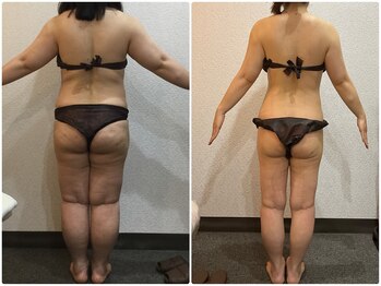 美容整体ウェリナ あま甚目寺院/小顔矯正/骨盤矯正/美脚サロン