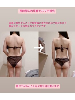トトノエル(TOTONOEL)/肩の盛り上がり改善