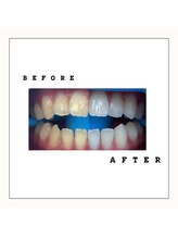 セルフダック 会津若松店(SELFDUCK)/BeforeAfter