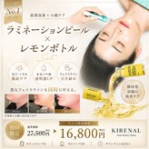 キレナル(KIRENAL)