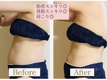 ヨサパーク シュエット(YOSA PARK CHOUETTE)/肋骨立てて、痩せやすい体へ♪