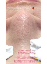 クレヴィー(Creviy)/浮き出る毛穴詰まり&汚れ