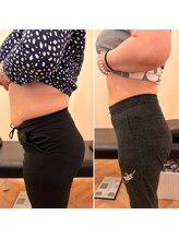 ナオ接骨院(NAO接骨院)/Before／After