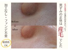 レヴィート(Revept)