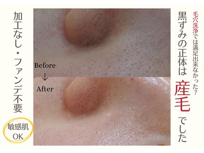 レヴィート(Revept)の写真