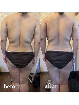 スワロ(suwaro)/滝汗×強圧デトックス