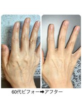 桃の木 吉祥寺店/乾燥にお薦め！補水エステ