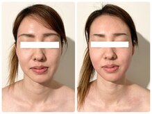 ドープ(Dope)/顔骨気