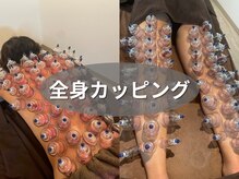 鍼灸院ワタナベコウヘイ(Watanabe Kohei)の雰囲気（カッピングのメニューもあり、150個のカップを使用します！）
