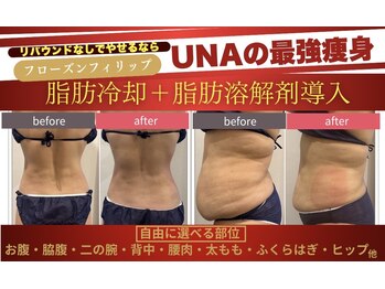 ウナトゥルービューティー(UNA true beauty)