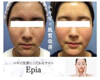 エピア 西尾店(Epia)
