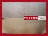 【痛み少ない×効果実感】VIO脱毛★都度払いモニター12,000円→7,000円
