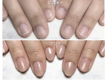 長さ出しスカルプ秋手の乾燥保湿