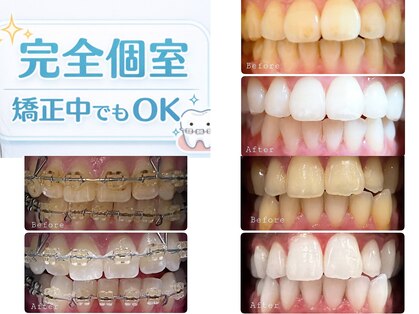 ホワイト アザブ(White Azabu)の写真