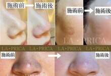 ラピリカ(LA PRICA)