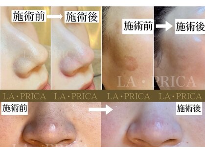 ラピリカ(LA PRICA)の写真