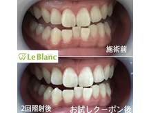 ルブラン 奈良店(Le Blanc)/効果実感してみて下さい！