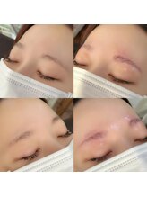 ナチュレ 久米川店(NATURE)/ハリウッドブロウリフト