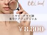 【ニキビ・凹凸でお悩みの方に】　BBLフェイシャル　60分