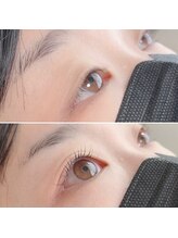 プローサム(Prorsum)/瞳に光を♪