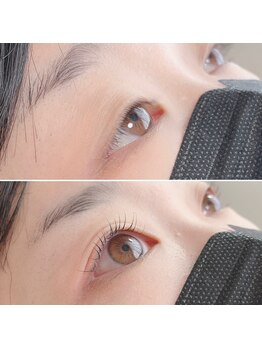 プローサム(Prorsum)/瞳に光を♪