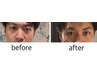 目の疲れ撃退コース　ヘッドマッサージ+目のシナプス療法　60分