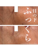 エステティックサロン ラ ベルタ(Esthetic Salon La Belta)/最強ケア！