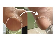 ピエモワ 表参道(PiEmoi)/足裏ツルツル♪