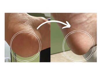 ピエモワ 表参道(PiEmoi)/足裏ツルツル♪