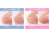 【巻き爪ケア導入キャンペーン】ジェルを塗り広げる！今だけ12760円→9900円