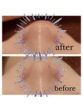 パリス デ スキン 岐阜マーサニジュウイチ店(Paris de skin)/【フェイシャル】Before/After