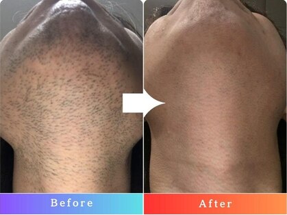 リエール(Le:YELL)の写真