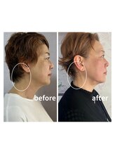 ウィッシュプロサロンケー(WISHpro salon K)/ウイッシュプロ×インディバ