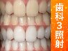 【会員／回数券】20分×3回歯科提携セルフホワイトニング
