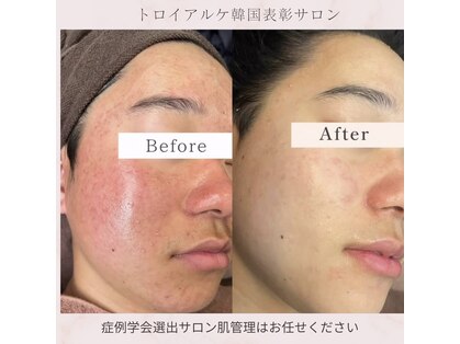 リラクゼーションサロン ラキ(laki)の写真