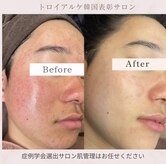 リラクゼーションサロン ラキ(laki)