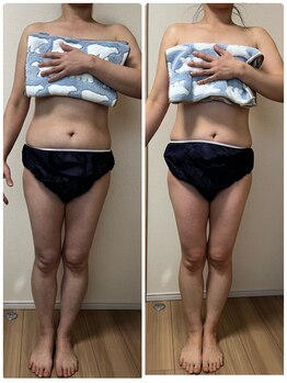 ローズ 下松(ROSE)/【筋膜リリース120分】