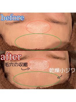 ヨシザワ インク 横浜みなとみらい桜木町店(YOSHIZAWA Inc.)/人気No.1 O2シェービングコース