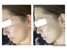 オアジスパ(Oasi Spa)/