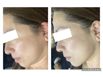 オアジスパ(Oasi Spa)/