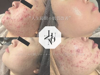 ルノン 天神店(LUNON)の写真