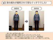 ピースフルポイント(Peaceful Point)/姿勢改善整体 before/After