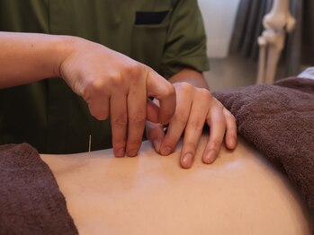 繁内鍼灸治療院の写真/【鍼灸×整体のWアプローチ】「年齢のせい」とあきらめていた腰のつらさを、根本から改善しませんか？ 