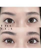 レピア 郡山駅前店/韓国式LEPIA Before&After