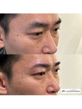 プラチナムブロウ 長岡(PLATINUM BROW)/美眉スタイリングのお客様　30代