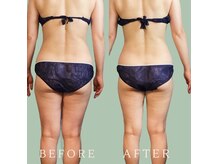 小さなおうちサロン こぐまの寝床の雰囲気(『毎月美しくなる肌へ』あなたのお肌に合わせたエイジングケアを)